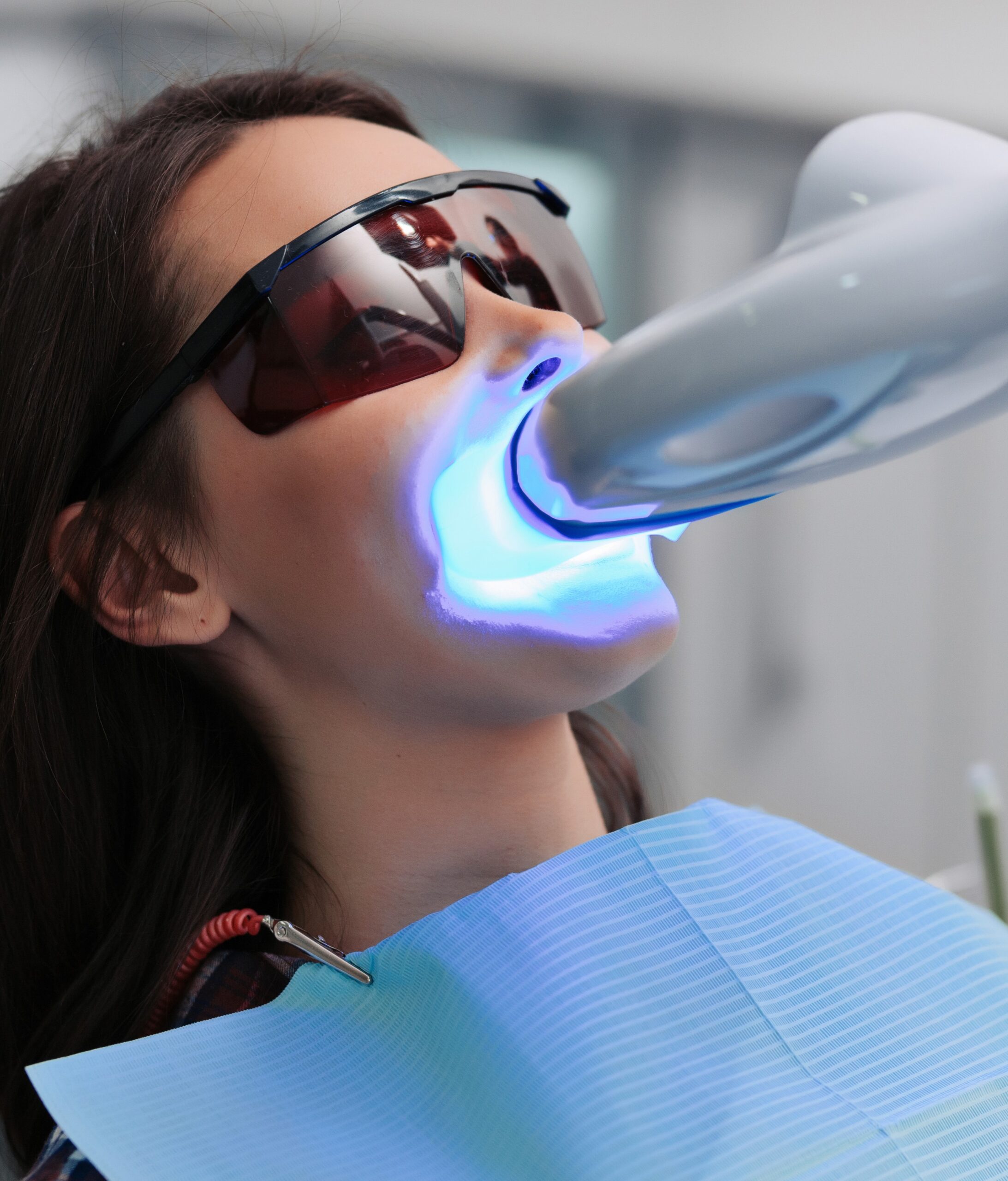 Teeth whitening for woman. Bleaching of the teeth at dentist clinic.