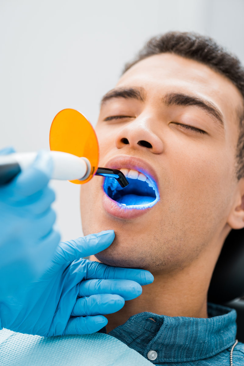 close up of handsome african american man with open mouth during whitening procedure